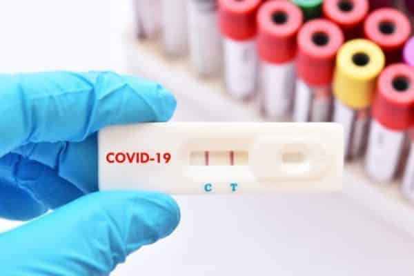 România donează Republicii Moldova 100.000 de teste antigen rapide ~ InfoPrut